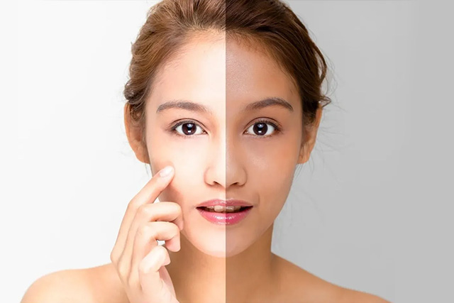 بهترین سفید کننده پوست – چگونه پوست خود را سفید کنیم