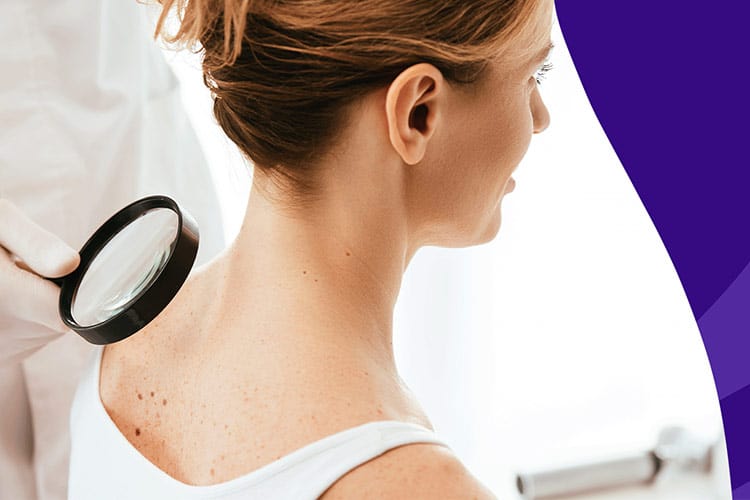 فواید کرم ضد آفتاب